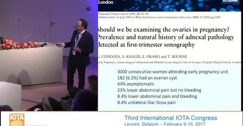 2017 IOTA Congress Managing ovarian cysts in pregnancy