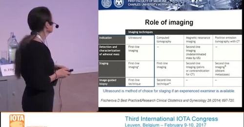 2017 IOTA Congress Using ultrasound to stage ovarian malignancy