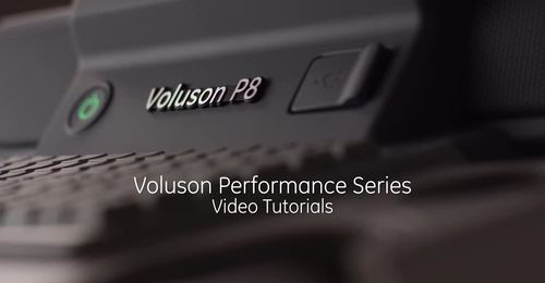 2017 - Voluson Signature & Performance BT16 - GYN educational video