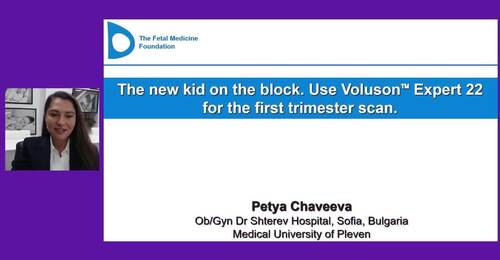 Dr. Petya Chaveeva: The new kid on the block. Use Voluson™ E ...