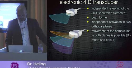 ISUOG 2016 Meet the e4D Expert: Dr. Heling- e4D Technology ...