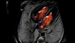 ISUOG Advanced Course