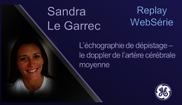 L’échographie de dépistage – le doppler de l’artère cérébral ...