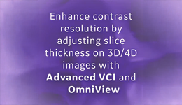 Voluson Advanced VCI and OmniView