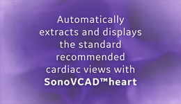 Voluson SonoVCAD™ heart