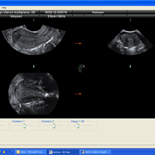 Application Tips & Tricks: 3D rendering of the endometrium ...