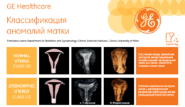 Uterus Abnormalities (RU)