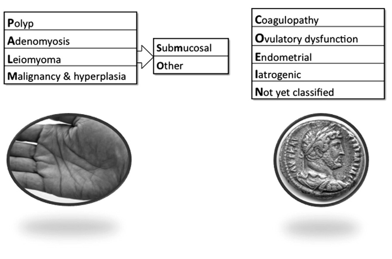 Basic classification system