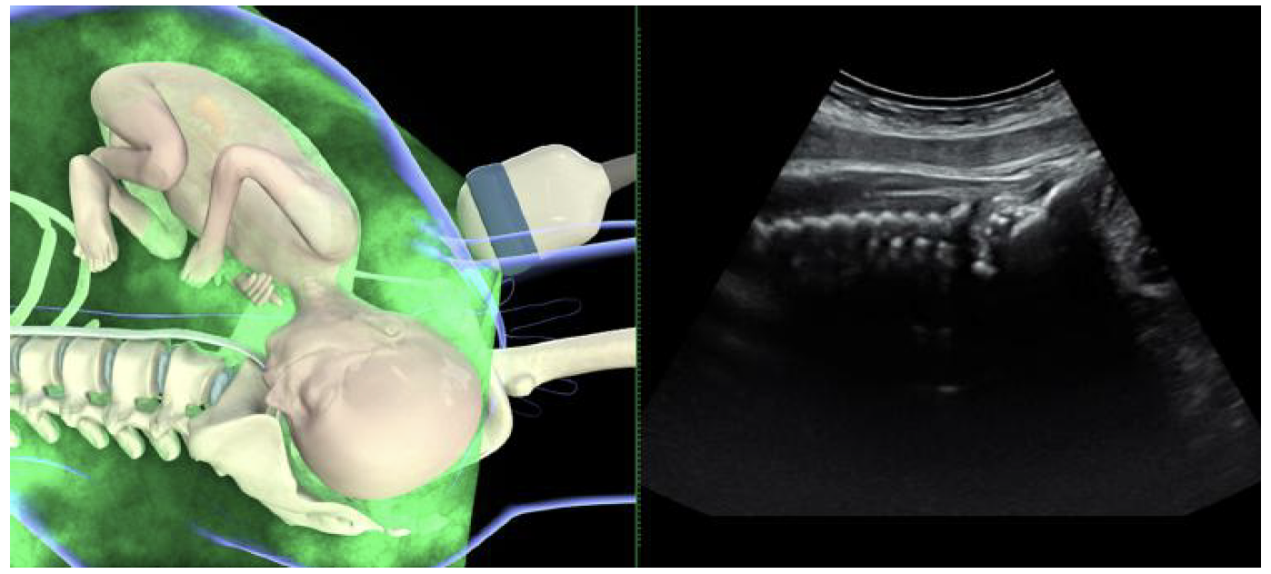 ISUOG Transabdominal ultrasound