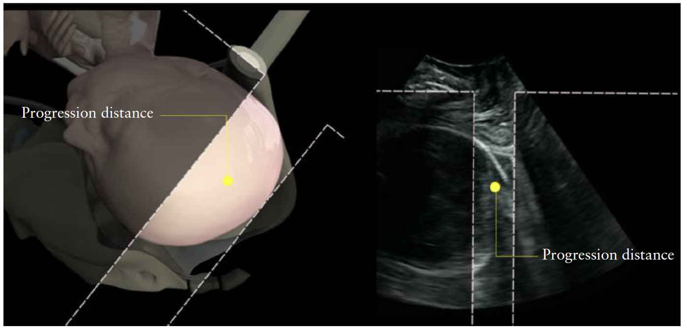 ISUOG Guidelins