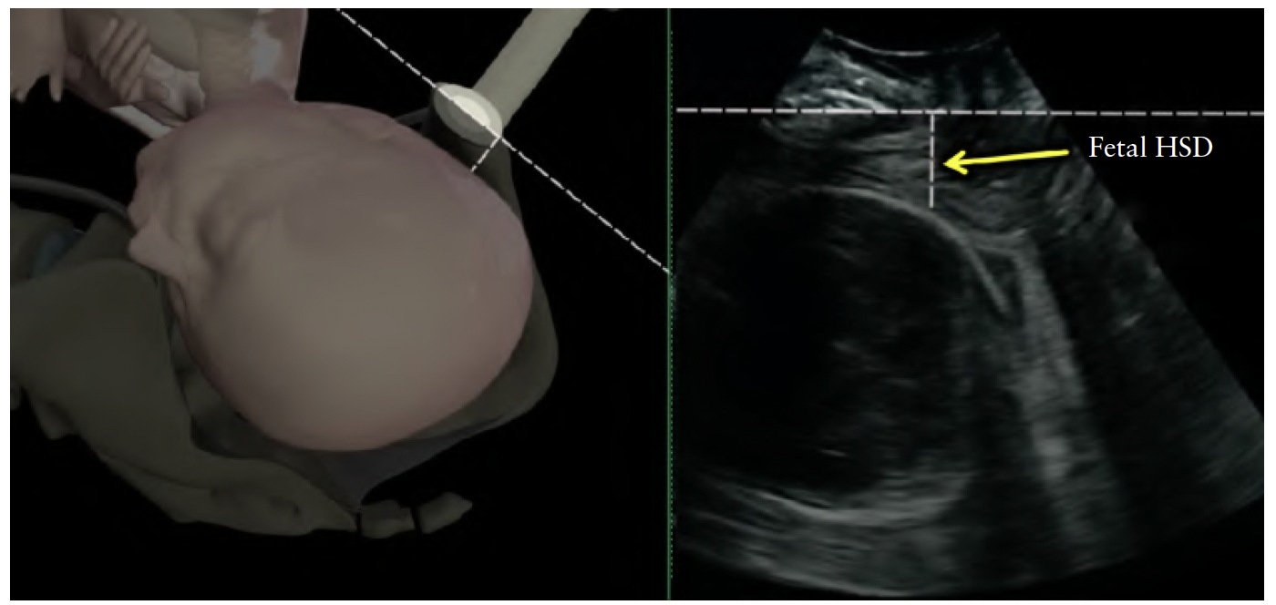 ISUOG Guidelins