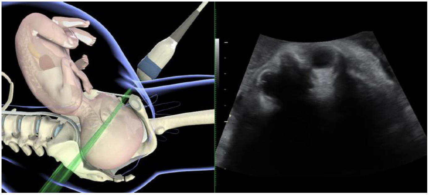 ISUOG Transabdominal ultrasound