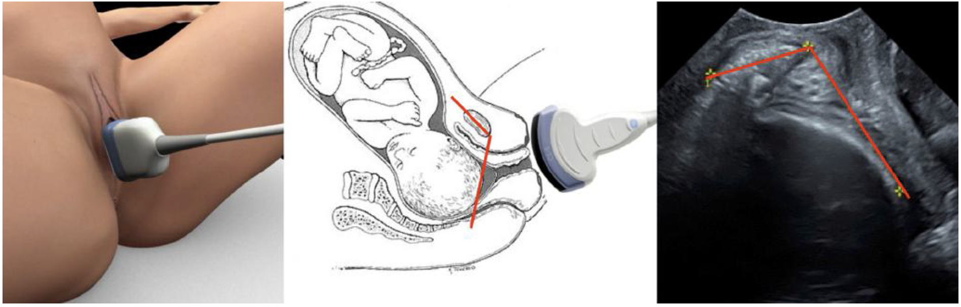 ISUOG Transabdominal ultrasound