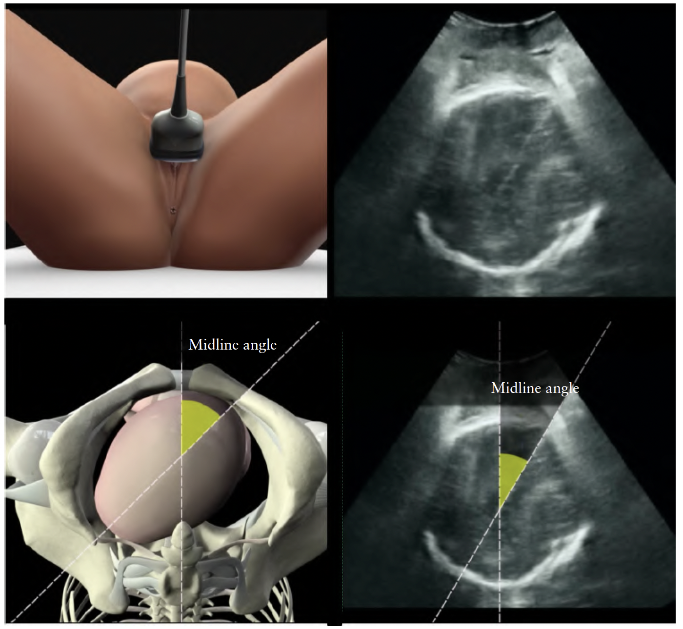 ISUOG Guidelins