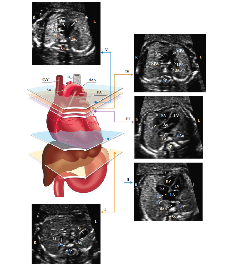 ISUOG Guidlines Figure 3