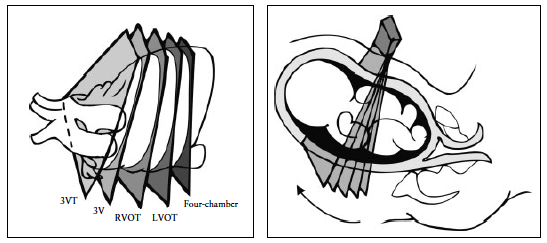 ISUOG Guidlines Figure 4