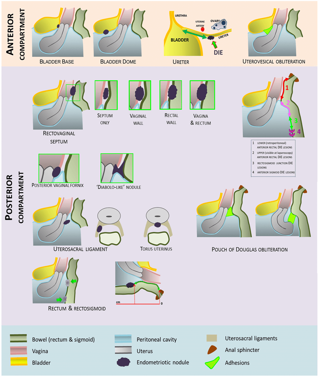 Idea Guidlines Figure13