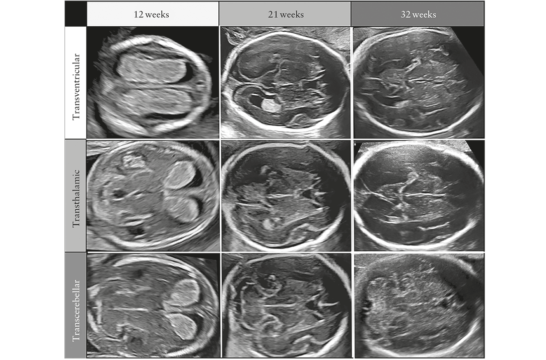 ISUOG Guidelines Figure 1