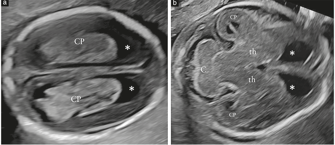 ISUOG Guidelines Figure 6